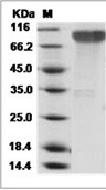 Epstein-Barr virus (Herpesvirus 4) EBV Glycoprotein gp350/EBV GP350 Protein (His)