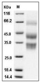 Clusterin Protein, Mouse, Recombinant (His)