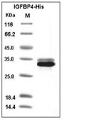 IGFBP-4 Protein, Human, Recombinant (His)