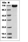 ENPP3 Protein, Rhesus, Recombinant (His)