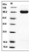 DLL4 Protein, Mouse, Recombinant (His)