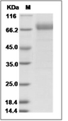 Influenza B (B/Brisbane/60/2008) Hemagglutinin/HA Protein