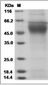 FLT1 Protein, Human, Recombinant (aa 1-328, His)