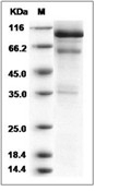 HGF Protein, Mouse, Recombinant