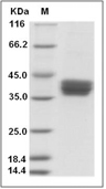 B3GALT5 Protein, Human, Recombinant (His)