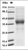 ASGR1 Protein, Human, Recombinant (His), Biotinylated