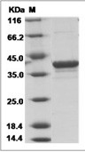 Matrix protein VP40