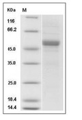 Apolipoprotein M/APOM Protein, Human, Recombinant (hFc)