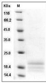 AGRP Protein, Human, Recombinant (His)