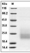 CD3D Protein, Human, Recombinant (His)