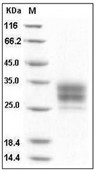 FCGR4 Protein, Mouse, Recombinant (His)