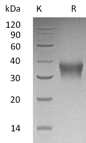 EPO/Erythropoietin Protein, Human, Recombinant (His)