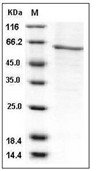 AKT1 Protein, Human, Recombinant (His)