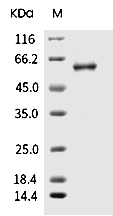 Influenza A H1N1 (A/Guangdong-Maonan/SWL1536/2019) Nucleoprotein/NP Protein (His)