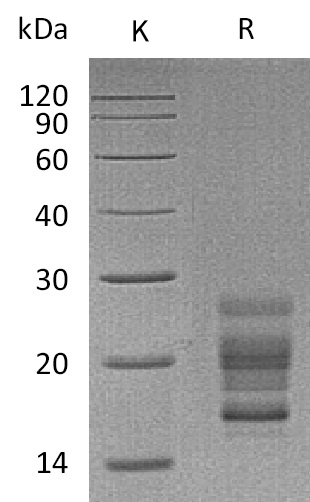 IL-17 Protein, Mouse, Recombinant (His)