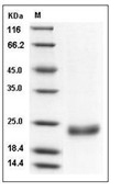 IL-28B Protein, Human, Recombinant (His)