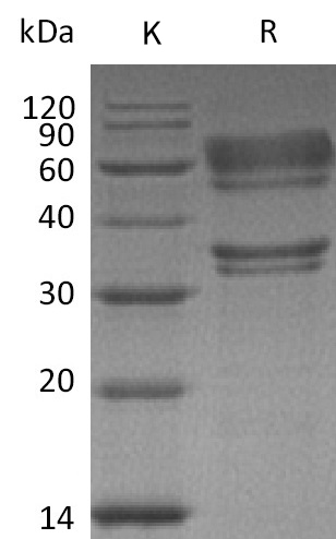 HGF Protein, Human, Recombinant (His)