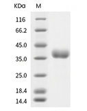 CD122/IL2RB Protein, Human, Recombinant