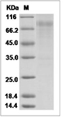 Influenza A H3N2 (A/Switzerland/9715293/2013) Hemagglutinin/HA0 Protein