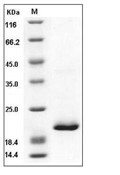 RBP4 Protein, Mouse, Recombinant (His)