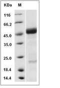 RAGE Protein, Human, Recombinant