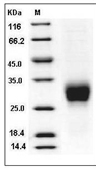 CD16a Protein, Rat, Recombinant (His)