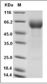 IL-18BP Protein, Human, Recombinant (aa 1-192, hFc)