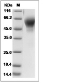 IL-1R2 Protein, Mouse, Recombinant (His)