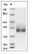 FGF-18 Protein, Human, Recombinant (His)