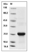 Tetranectin Protein, Mouse, Recombinant (His)