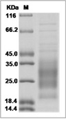 IL-31 Protein, Mouse, Recombinant (His)