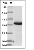 IGFBP-5 Protein, Human, Recombinant (His)