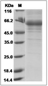 Adiponectin Protein, Human, Recombinant (hFc)