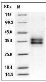 FOLR1 Protein, Mouse, Recombinant (His)