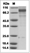 Influenza A H3N2 (A/Perth/16/2009) Hemagglutinin/HA0 Protein