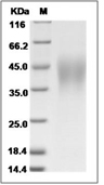 Fc epsilon RI Protein, Human, Recombinant