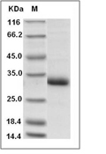 Adiponectin Protein, Human, Recombinant (His)