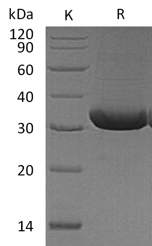 RANKL/TNFSF11/CD254 Protein, Mouse, Recombinant (His)