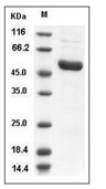 IRAK4 Protein, Human, Recombinant (His)