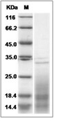 IL-13 Protein, Mouse, Recombinant