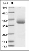 CXCL16 Protein, Human, Recombinant (His)