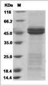 IL-11R alpha chain 1/IL-11RA1 Protein, Rat, Recombinant (His)