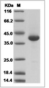 LY6D Protein, Human, Recombinant (mFc)