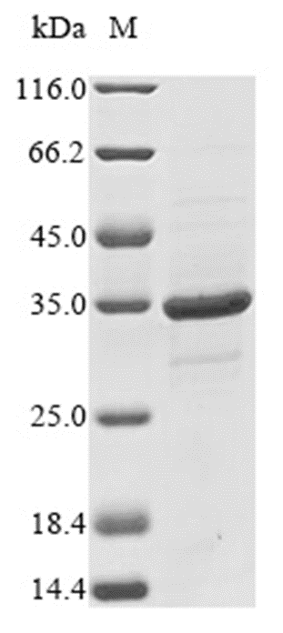 Erythroferrone Protein, Human, Recombinant (His & SUMO)