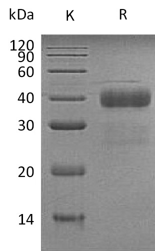 Kallikrein 5/KLK5 Protein, Human, Recombinant (His)