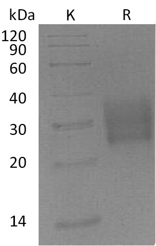 TGFBR2 Protein, Mouse, Recombinant (His)