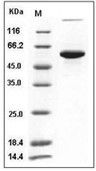 P4HB Protein, Human, Recombinant (His)