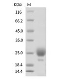 HE4 Protein, Human, Recombinant (His)