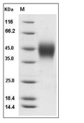 IFNGR1 Protein, Mouse, Recombinant (His)