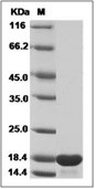 MMP-12 Protein, Human, Recombinant (catalytic domain)